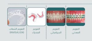 التقويم المعدني