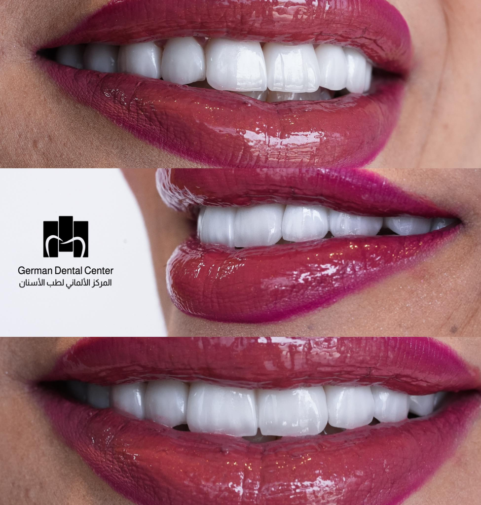 الجراحات الفموية والتجميل اللاجراحي